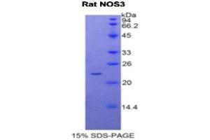 SDS-PAGE (SDS) image for Nitric Oxide Synthase 3 (Endothelial Cell) (NOS3) (AA 519-702) protein (His tag) (ABIN1877325) (ENOS Protein (AA 519-702) (His tag))