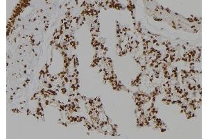 ABIN6276767 at 1/100 staining Rat lung tissue by IHC-P. (CSNK2A2 抗体  (N-Term))