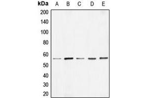 Western blot analysis of BMP7 expression in HEK293T (A), Raw264. (BMP7 抗体  (Center))