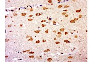 Paraformaldehyde-fixed, paraffin embedded rat brain, Antigen retrieval by boiling in sodium citrate buffer (pH6.