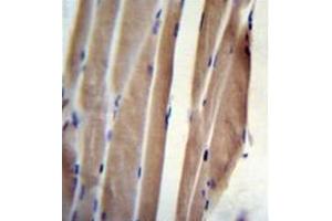 Immunohistochemistry (Paraffin-embedded Sections) (IHC (p)) image for anti-Polymerase (RNA) II (DNA Directed) Polypeptide J, 13.3kDa (POLR2J) (AA 93-117), (C-Term) antibody (ABIN954242)