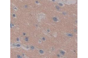 IHC-P analysis of Human Tissue, with DAB staining. (PPL 抗体  (AA 1439-1716))