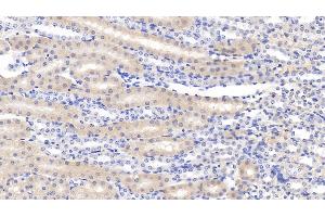 Detection of CLIC4 in Mouse Kidney Tissue using Polyclonal Antibody to Chloride Intracellular Channel Protein 4 (CLIC4) (CLIC4 抗体  (AA 104-253))