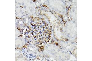 Immunohistochemistry (IHC) image for anti-Apolipoprotein E (APOE) (AA 200-300) antibody (ABIN6137017)