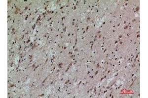 Immunohistochemical analysis of paraffin-embedded human-brain, antibody was diluted at 1:100. (CD58 抗体  (Internal Region))