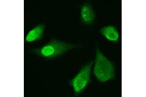 IF analysis of ADK using anti-ADK antibody (ABIN4886430). (ADK 抗体  (AA 165-351))