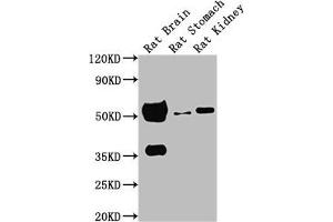 Western Blotting (WB) image for anti-Tubulin, alpha 1a (Tuba1a) antibody (ABIN7127861)