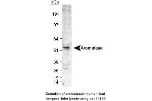 Image no. 1 for anti-Cytochrome P450, Family 19, Subfamily A, Polypeptide 1 (CYP19A1) (C-Term) antibody (ABIN363492) (Aromatase 抗体  (C-Term))