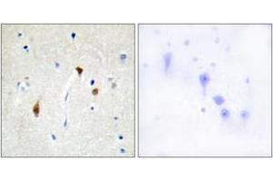 Immunohistochemistry analysis of paraffin-embedded human brain tissue, using HAIR Antibody. (Hairless 抗体  (AA 41-90))