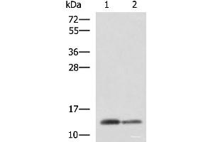 Western blot analysis of Human breast tissue and Human thyroid tissue lysates using CRABP1 Polyclonal Antibody at dilution of 1:2000 (CRABP1 抗体)