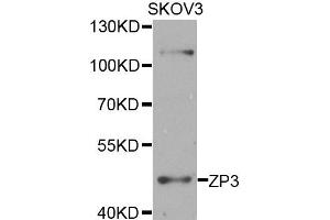 Western blot analysis of extracts of SKOV3 cells, using ZP3 antibody. (Zona Pellucida Glycoprotein 3 抗体)