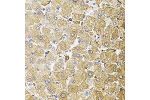 Immunohistochemistry of paraffin-embedded human liver damage using CEP164 antibody (ABIN6131021, ABIN6138417, ABIN6138418 and ABIN6225304) (40x lens).
