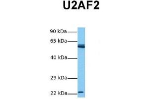 Host:  Rabbit  Target Name:  U2AF2  Sample Tissue:  Human Jurkat  Antibody Dilution:  1. (U2AF2 抗体  (N-Term))