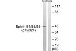 Western blot analysis of extracts from K562 cells treated with serum 20% 15', using Ephrin B1/B2/B3 (Phospho-Tyr324) Antibody. (Ephrin B1/B2/B3 (AA 290-339), (pTyr324) 抗体)