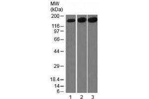 Western blot testing of 1) human HepG2, 2) HeLa and 3) mouse NIH3T3 cell lysate with Topoisomerase II alpha antibody (clone TOP2A/1361). (Topoisomerase II alpha 抗体  (AA 1352-1493))