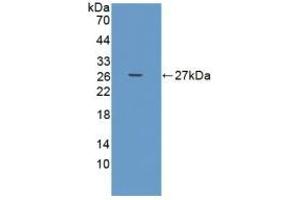 Detection of Recombinant ADAMTS9, Human using Polyclonal Antibody to A Disintegrin And Metalloproteinase With Thrombospondin 9 (ADAMTS9) (ADAMTS9 抗体  (AA 1727-1935))