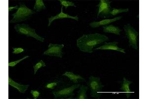 Immunofluorescence of monoclonal antibody to GFRA1 on HeLa cell. (GFRA1 抗体  (AA 32-119))