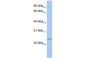 WB Suggested Anti-PRELID2 Antibody Titration: 0. (PRELID2 抗体  (C-Term))