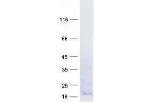 Western Blotting (WB) image for Zinc Finger, C3HC-Type Containing 13 (ZCCHC13) protein (Myc-DYKDDDDK Tag) (ABIN2735802)