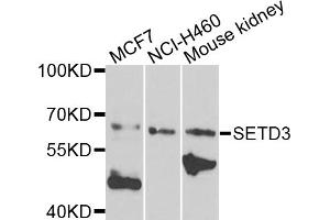 Western blot analysis of extracts of various cell lines, using SETD3 antibody (ABIN5974648) at 1/1000 dilution. (SETD3 抗体)