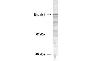 dilution: 1 : 1000, sample: rat brain homogenate (SHANK1 抗体  (AA 135-149))