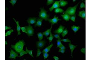 Immunofluorescence staining of SH-SY5Y cells with ABIN7164419 at 1:50, counter-stained with DAPI. (Deltex Homolog 3 抗体  (AA 90-347))