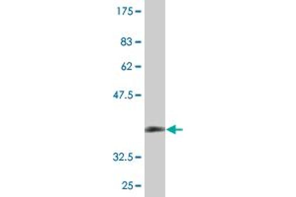 ZDHHC13 anticorps  (AA 181-280)