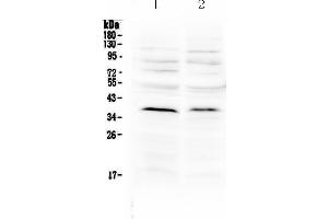 Western blot analysis of MATH1/HATH1 using anti-MATH1/HATH1 antibody . (ATOH1 抗体  (N-Term))