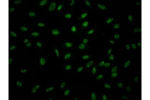 Immunofluorescence staining of Hela Cells with ABIN7127523 at 1:50, counter-stained with DAPI. (Recombinant GZMB 抗体)