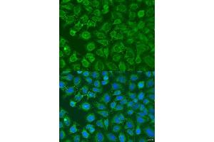 Immunofluorescence analysis of U2OS cells using EIF2B1 antibody (ABIN6132115, ABIN6140035, ABIN6140036 and ABIN6223878) at dilution of 1:100. (EIF2B1 抗体  (AA 1-305))