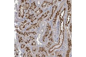 Immunohistochemical staining of human kidney with MDGA1 polyclonal antibody  shows strong membranous positivity in cells in tubules.