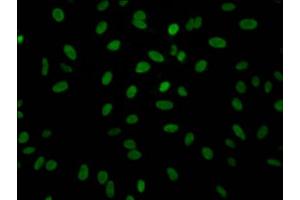 Immunofluorescence staining of Hela Cells with ABIN7127334 at 1:50, counter-stained with DAPI. (Recombinant ALDOA 抗体)