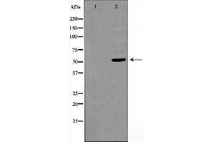 Western blot analysis of extracts from HeLa cells using CELF-1 antibody.