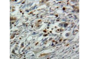 #VALUE! (EBI3 抗体  (AA 21-229))