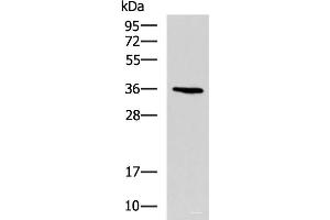Western blot analysis of A549 cell lysate using BDNF Polyclonal Antibody at dilution of 1:900 (BDNF 抗体)