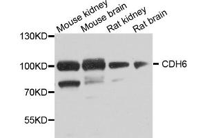 Western blot analysis of extracts of various cell lines, using CDH6 antibody (ABIN5974784) at 1/1000 dilution. (CDH6 抗体)