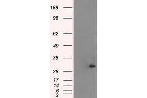 Western Blotting (WB) image for anti-Cardiac Troponin I (TNNI3) (AA 1-210) antibody (ABIN1490609) (TNNI3 抗体  (AA 1-210))
