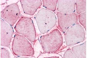 Human Skeletal Muscle: Formalin-Fixed, Paraffin-Embedded (FFPE) (SEMA4B 抗体  (Internal Region))