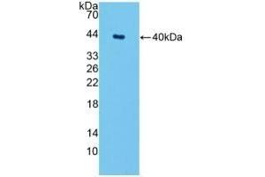 Detection of Recombinant SPTLC1, Mouse using Polyclonal Antibody to Serine Palmitoyltransferase, Long Chain Base Subunit 1 (SPTLC1) (SPTLC1 抗体  (AA 143-473))