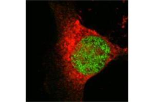 Confocal immunofluorescence analysis of Eca 109 cells using MOF/MYST1 mouse mAb (green), showing nuclear localization. (MYST1 抗体)