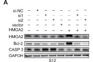 Expression of HMGA2 and its related genes in S12, SiHa, and CaSki cellsWestern blot analysis of HMGA2, Bcl-2, and Caspase 3 protein expression in S12 (A), SiHa (B), and CaSki (C) cells and control cells after treatment with HMGA2 overexpression plasmid or siRNAs. (Caspase 3 抗体  (AA 55-160))