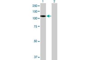 Western Blot analysis of CSF3R expression in transfected 293T cell line by CSF3R MaxPab polyclonal antibody. (CSF3R 抗体  (AA 1-836))