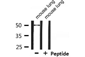 Western blot analysis of extracts from mouse lung, using Retinoic Acid Receptor beta Antibody.