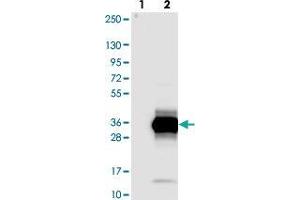 Western blot analysis of Lane 1: Negative control (vector only transfected HEK293T lysate). (ZCCHC10 抗体)