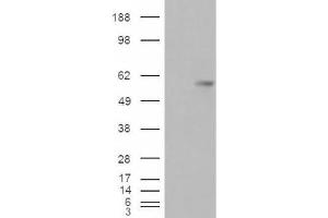 Western Blotting (WB) image for anti-V-Set Domain Containing T Cell Activation Inhibitor 1 (VTCN1) (Internal Region) antibody (ABIN2466446) (VTCN1 抗体  (Internal Region))