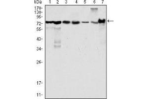 Western blot analysis using LPP mouse mAb against Hela (1), NIH/3T3 (2), COS (3), Caki (4), MCF-7 (5), HepG2 (6) and SMMC-7721 (7) cell lysate. (LPP 抗体)