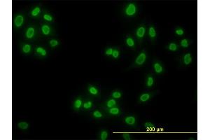 Immunofluorescence of monoclonal antibody to HDAC1 on HeLa cell. (HDAC1 抗体  (AA 1-482))