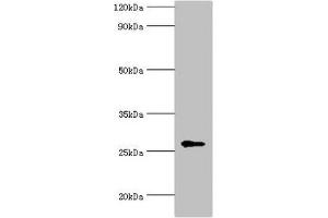 Western blot All lanes: N-alpha-acetyltransferase 10 antibody at 5 μg/mL + Hela whole cell lysate Secondary Goat polyclonal to rabbit IgG at 1/10000 dilution Predicted band size: 27, 25 kDa Observed band size: 27 kDa (PTPDC1 抗体  (AA 161-235))