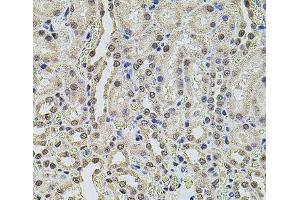 Immunohistochemistry of paraffin-embedded Rat kidney using SMARCC2 Polyclonal Antibody at dilution of 1:100 (40x lens). (SMARCC2 抗体)