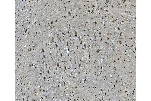 IHC analysis of LSM7 using anti-LSM7 antibody (ABIN7598937). (LSM7 抗体  (AA 1-103))
